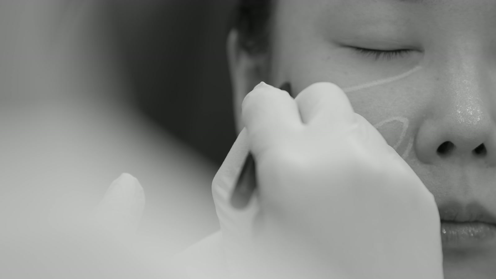 피부 진단 장비로 환자의 피부결과 탄력 상태를 확인하는 모습