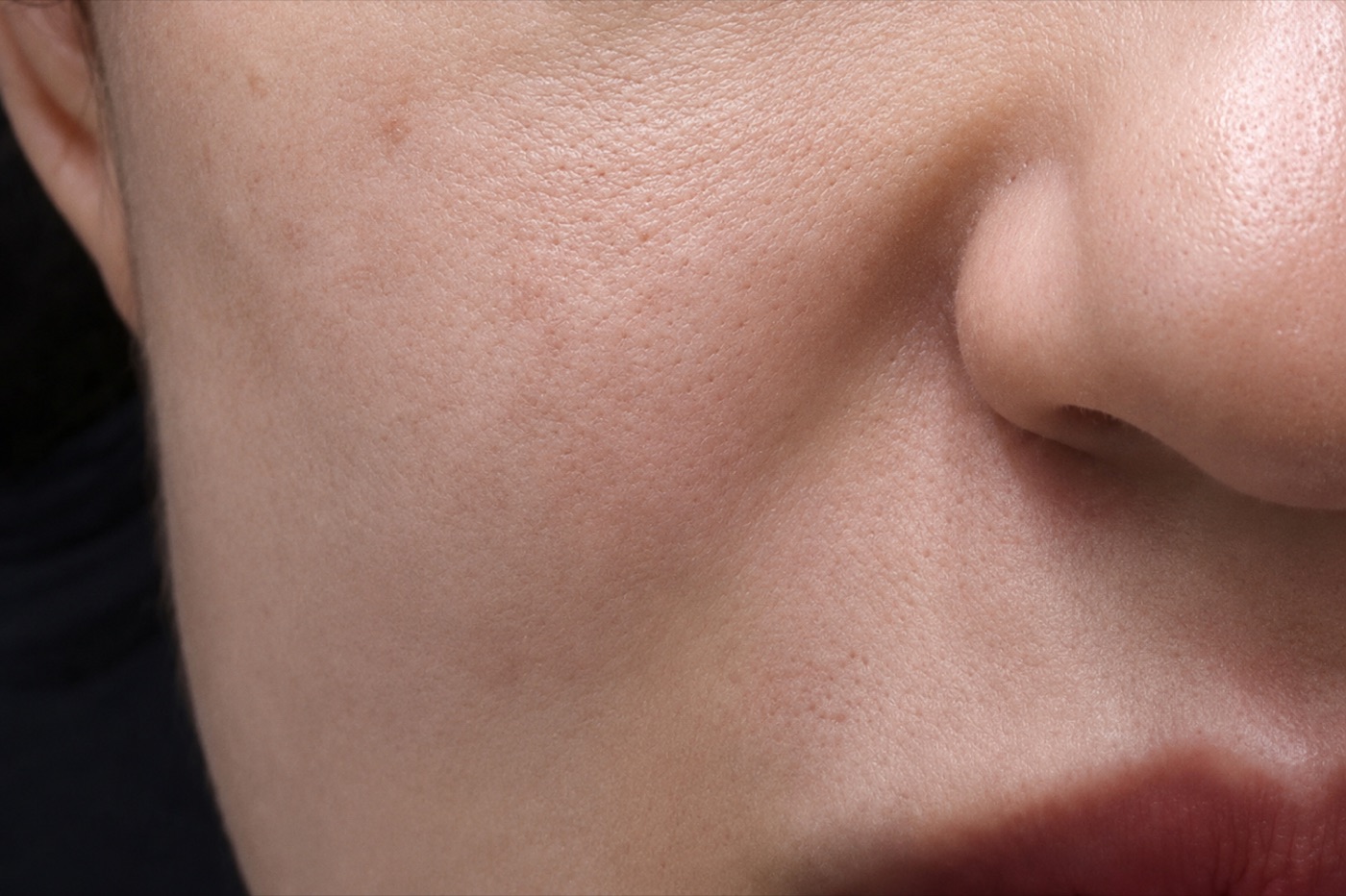 Before treatment