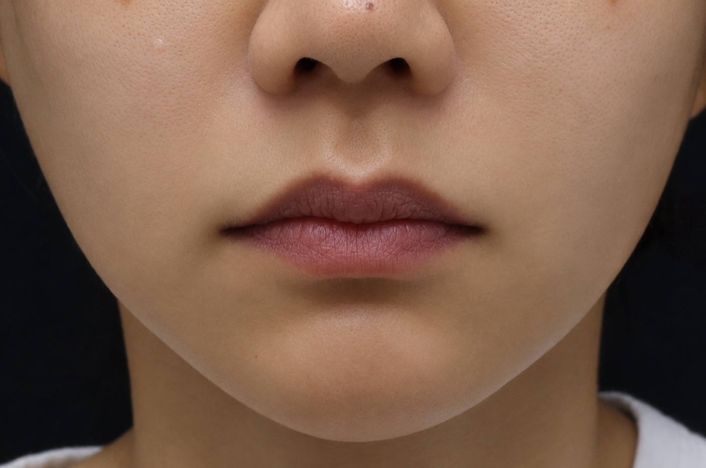 After treatment
