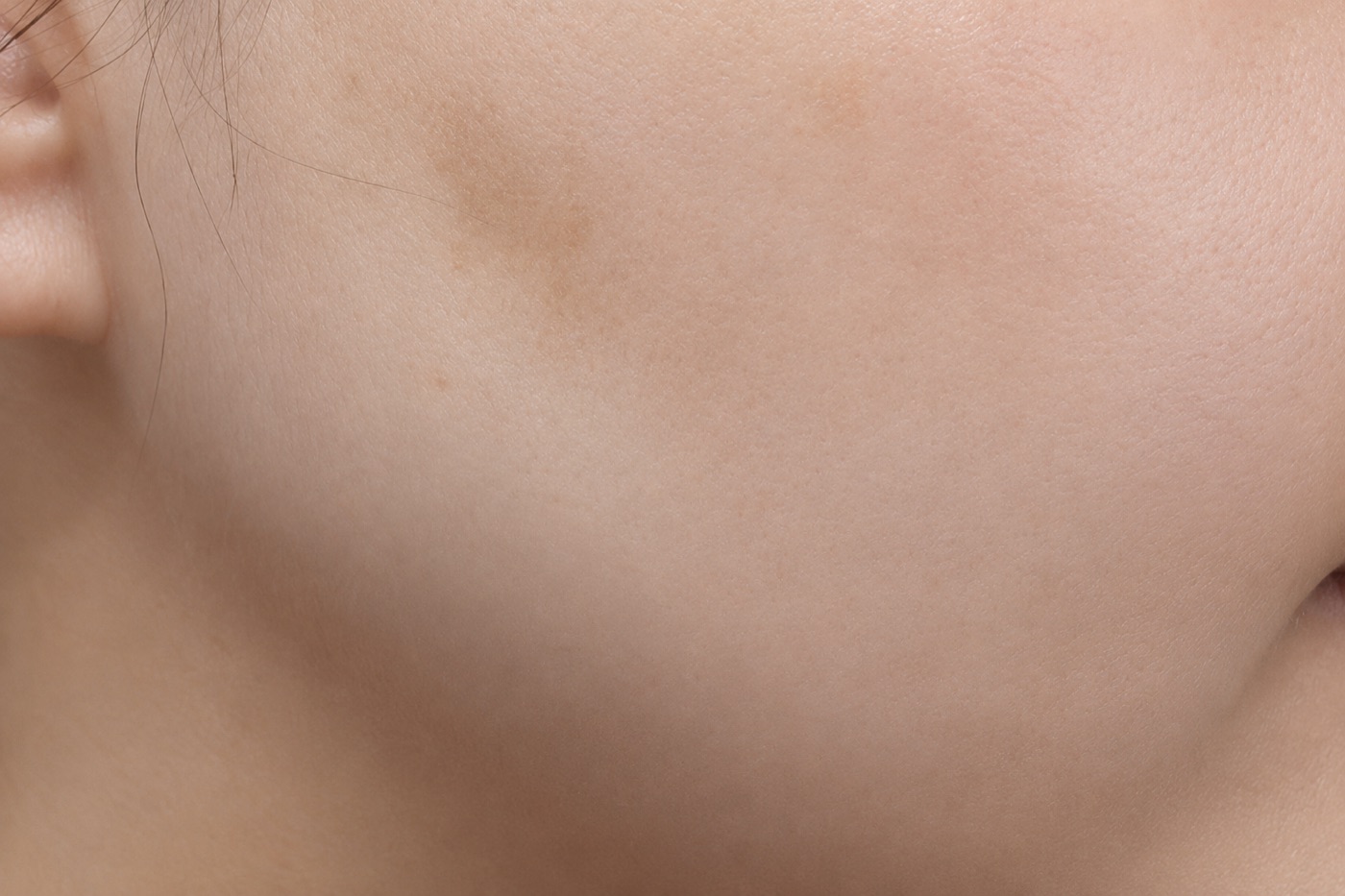 After treatment
