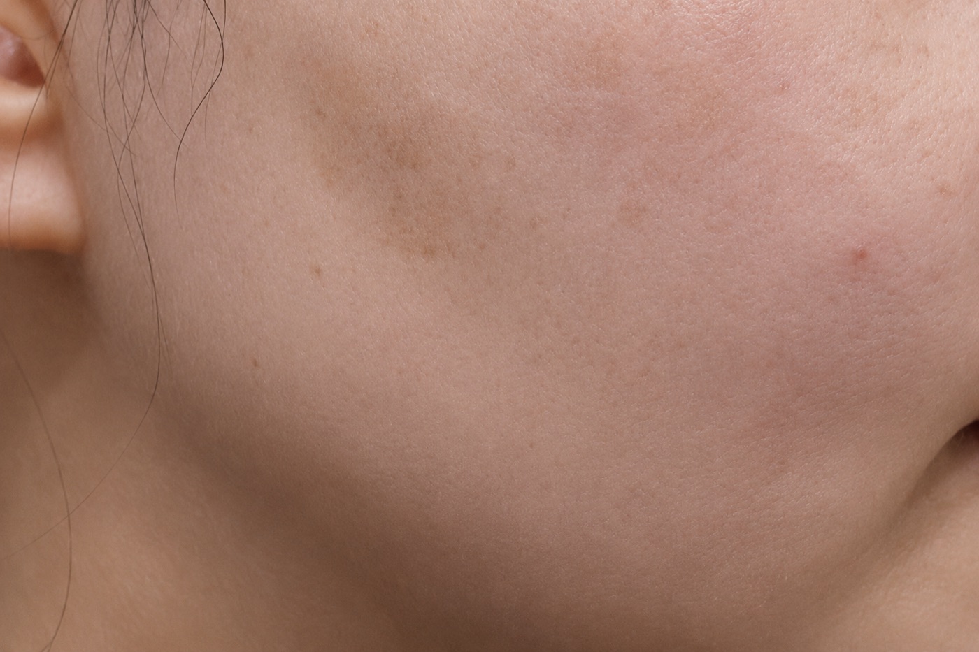Before treatment