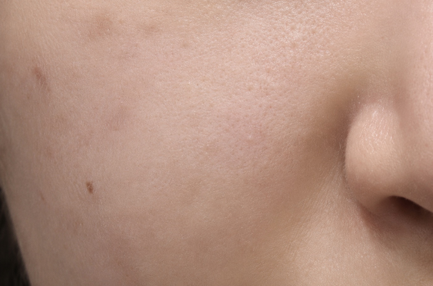 After treatment