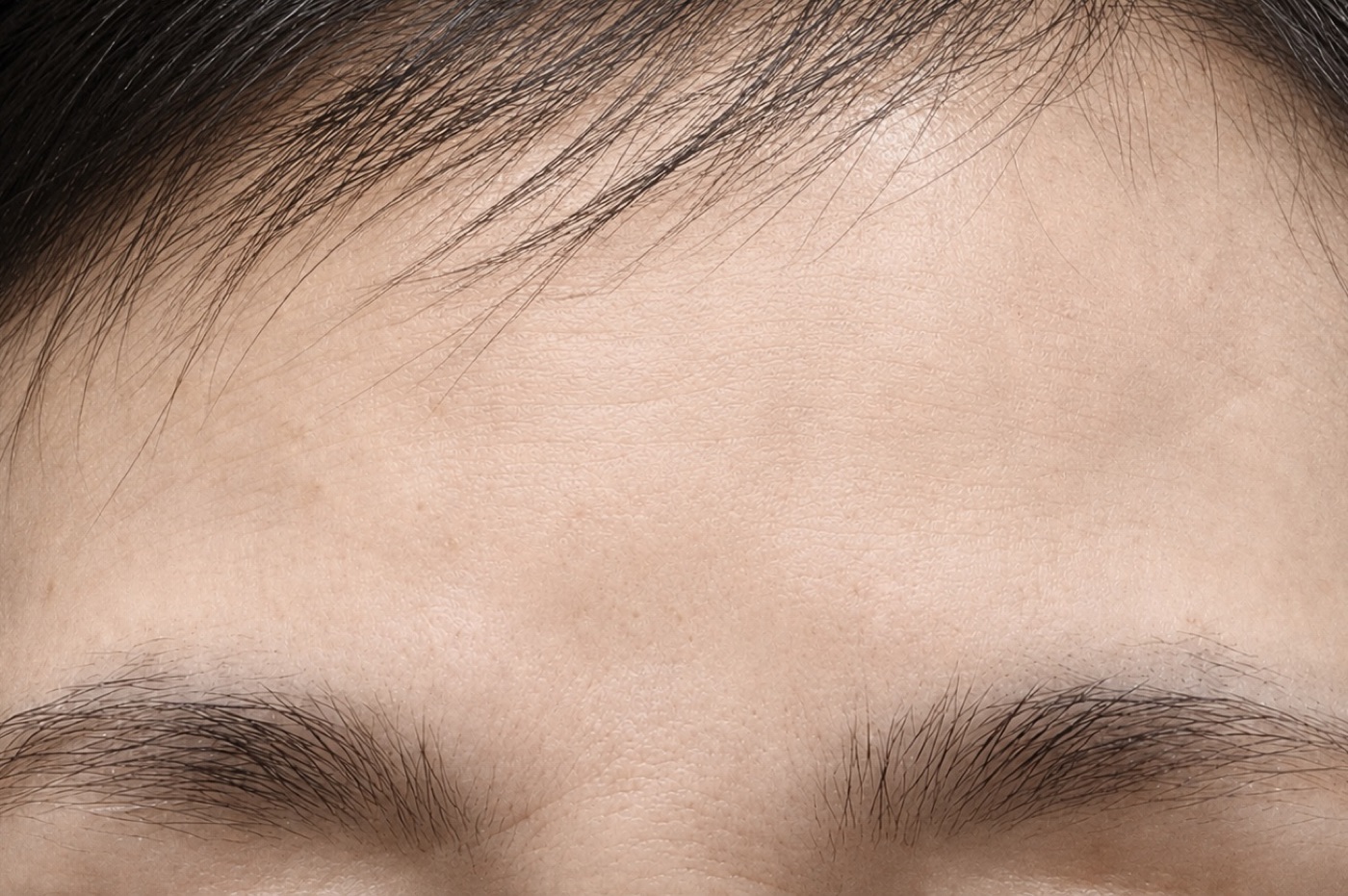 After treatment