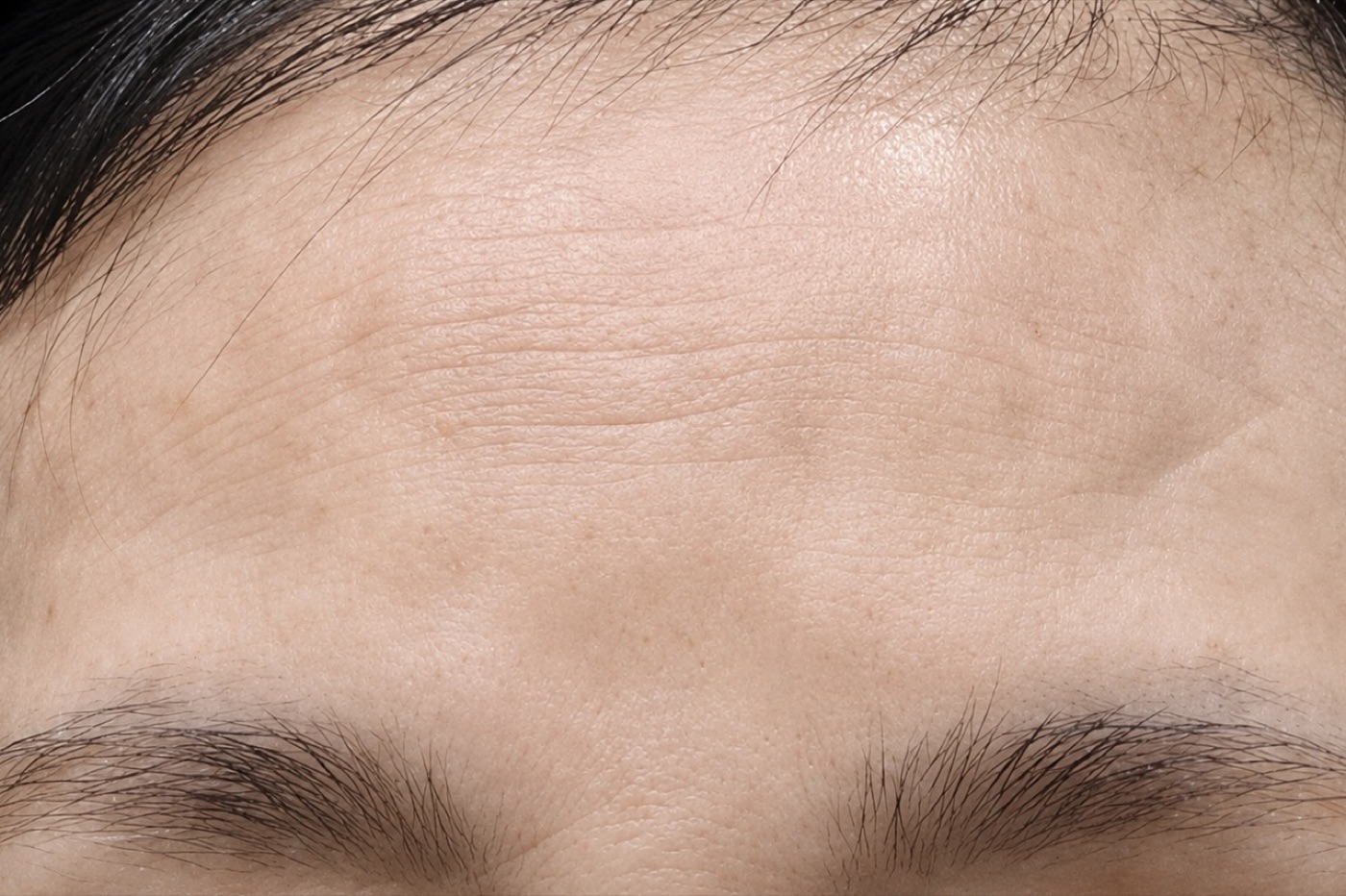 Before treatment